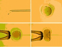 哈萨克斯坦做三代试管大概要多少钱？