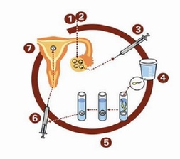 助孕生子一二三代试管的费用是多少？附国内试管助孕医院推荐