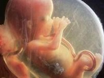 俄罗斯试管婴儿助孕技术，跨国生殖医疗新选择